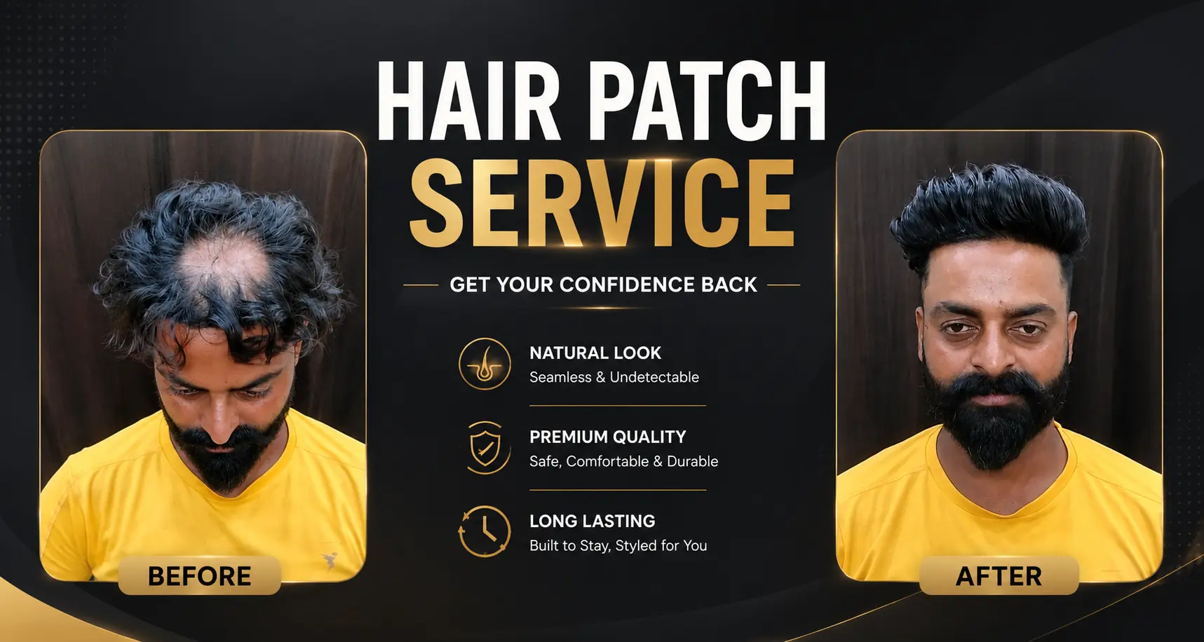 Hair patch service before and after transformation by Bhargav Hair Fix